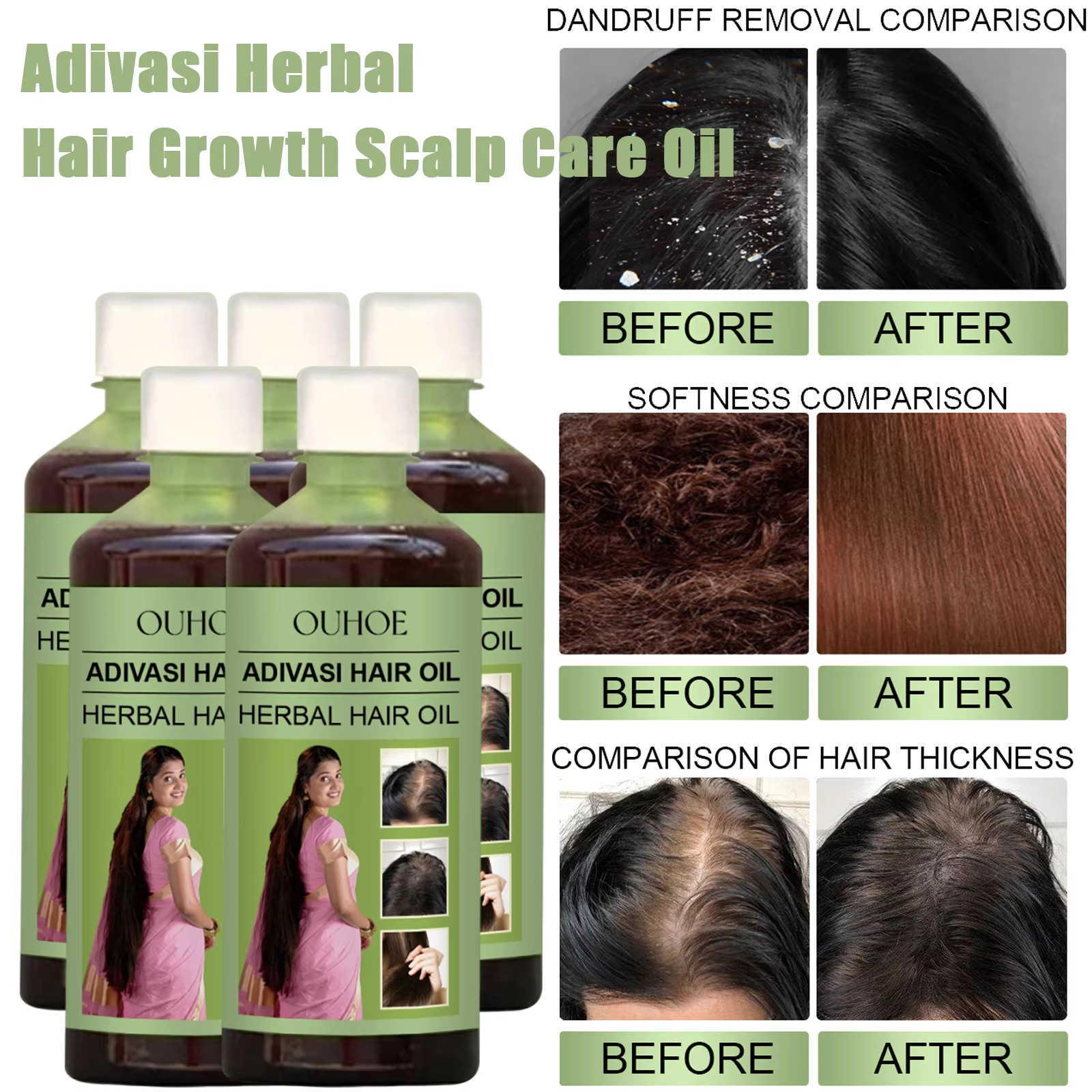 Hair Care Dandruff - 100ml Hair Growth Oil India Adivasi