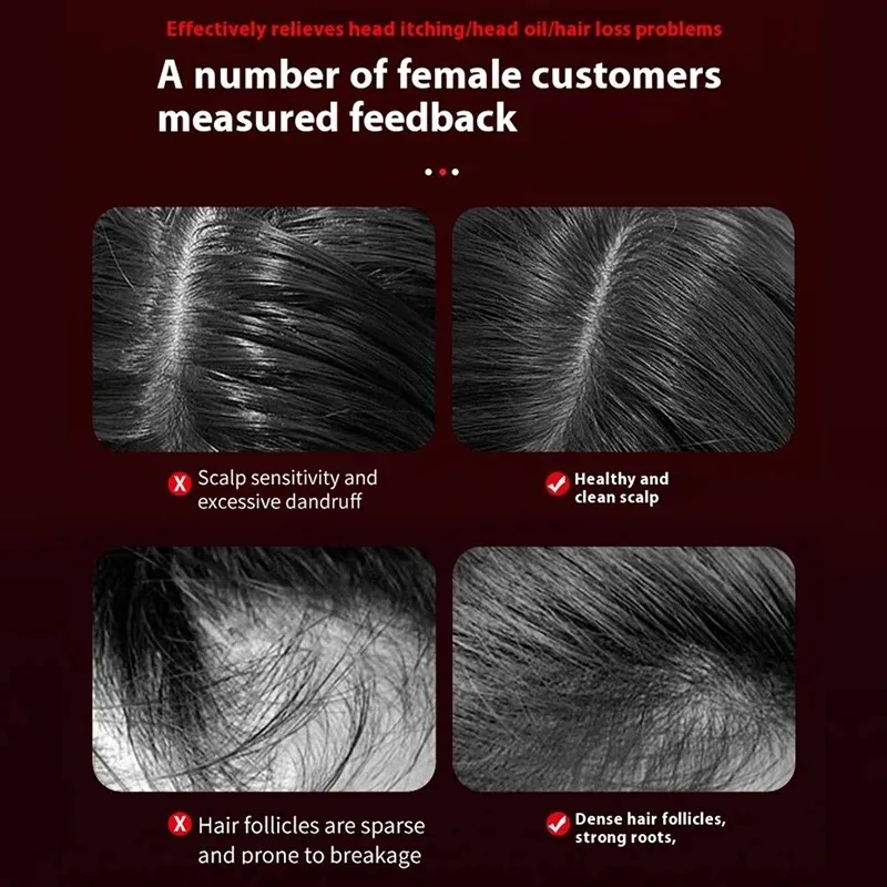 Electric Vibration Massage Com - Hair Care Essence 리뷰 및 가격