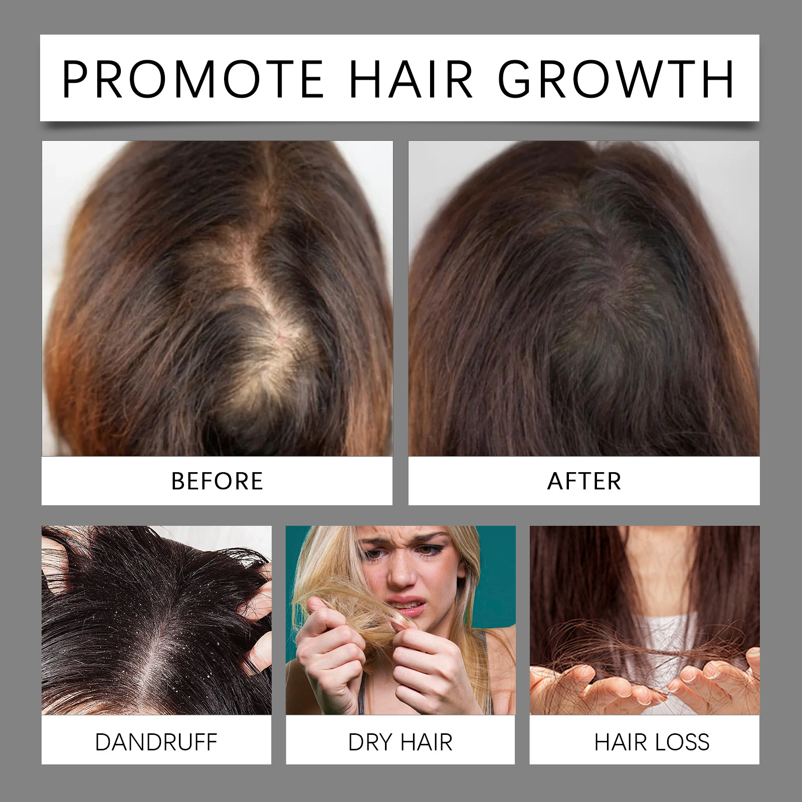 30ml Hair Care Essential Oil T - Hair Care Essence 리뷰 및 가격