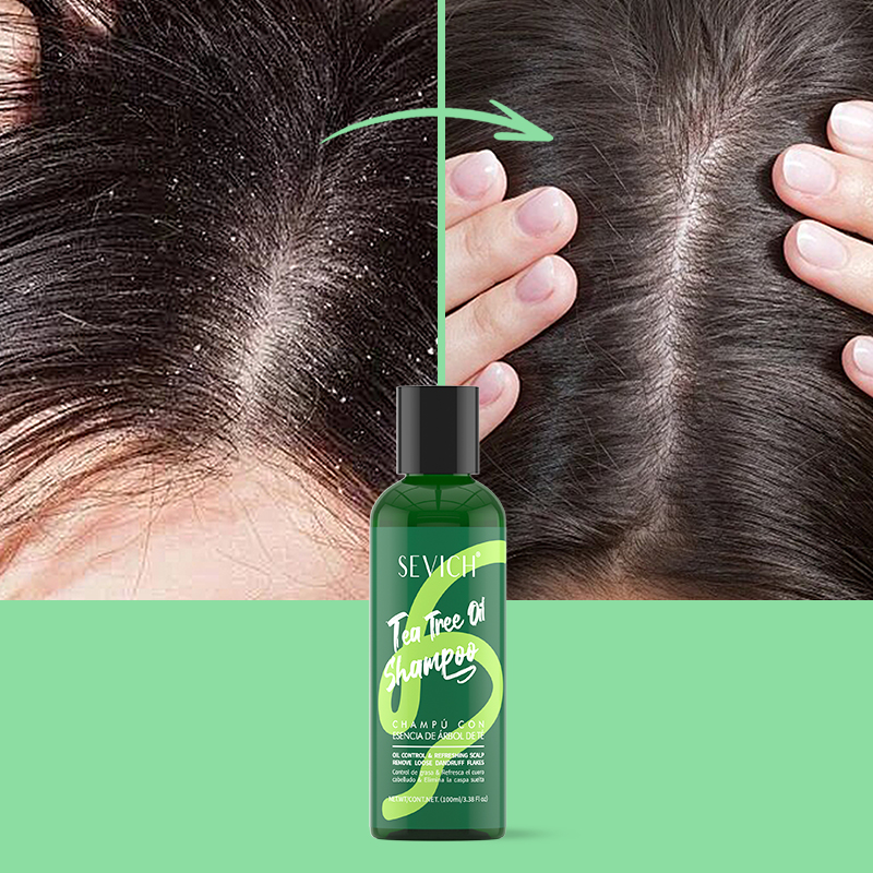 Tea Tree Essence Shampoo Hair  - Hair Care Essence 리뷰 및 가격