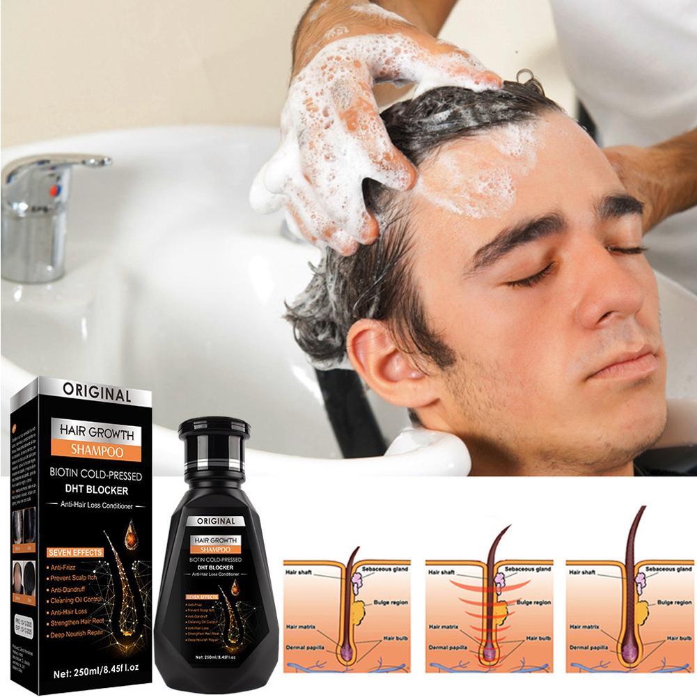 250ML Biotin Ginger Shampoo Co - Biotin Shampoo Thickening 리뷰 및 가격
