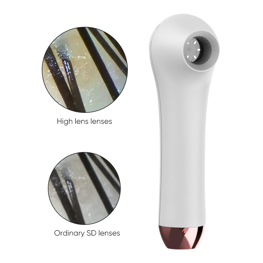 Home Use HD Dermatology Face S - Hair Care Homemade 리뷰 및 가격