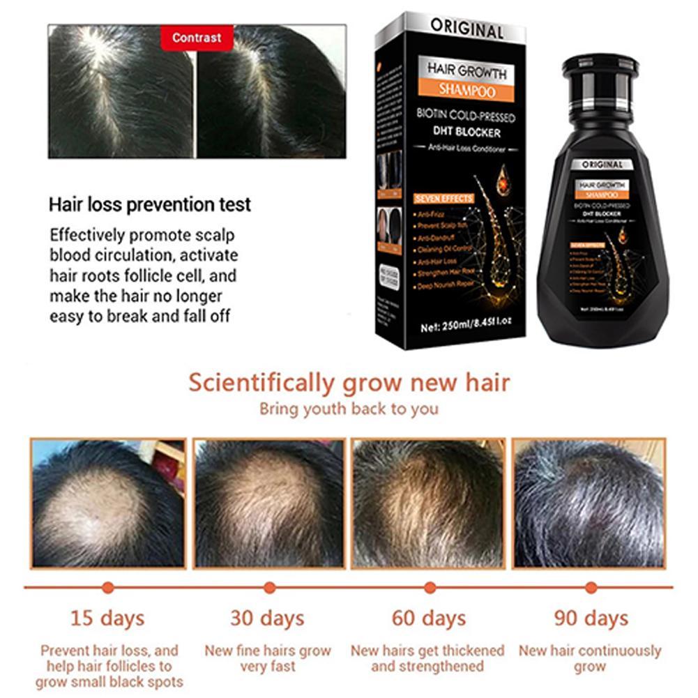Biotin Ginger shampoo Thickeni - Biotin Shampoo Thickening 리뷰 및 가격