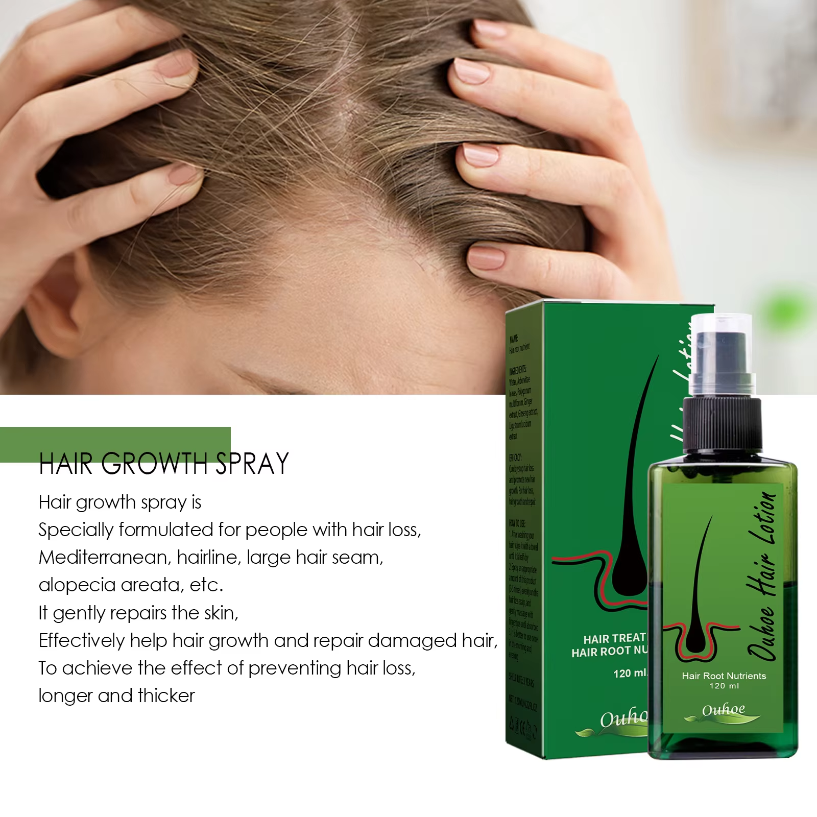 Hair Growth Spray Anti Hair Lo - Hair Care Essence 리뷰 및 가격