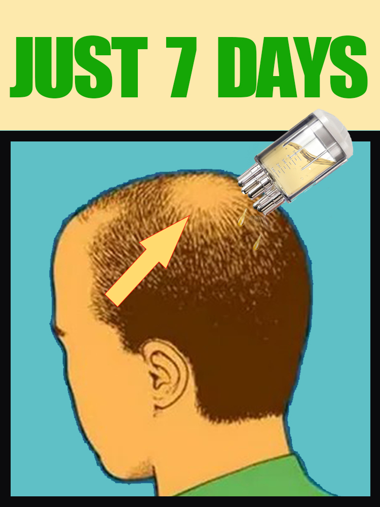 2025 NEW UPGRADE Scalp Applica - Hair Care Oil Serum 리뷰 및 가격