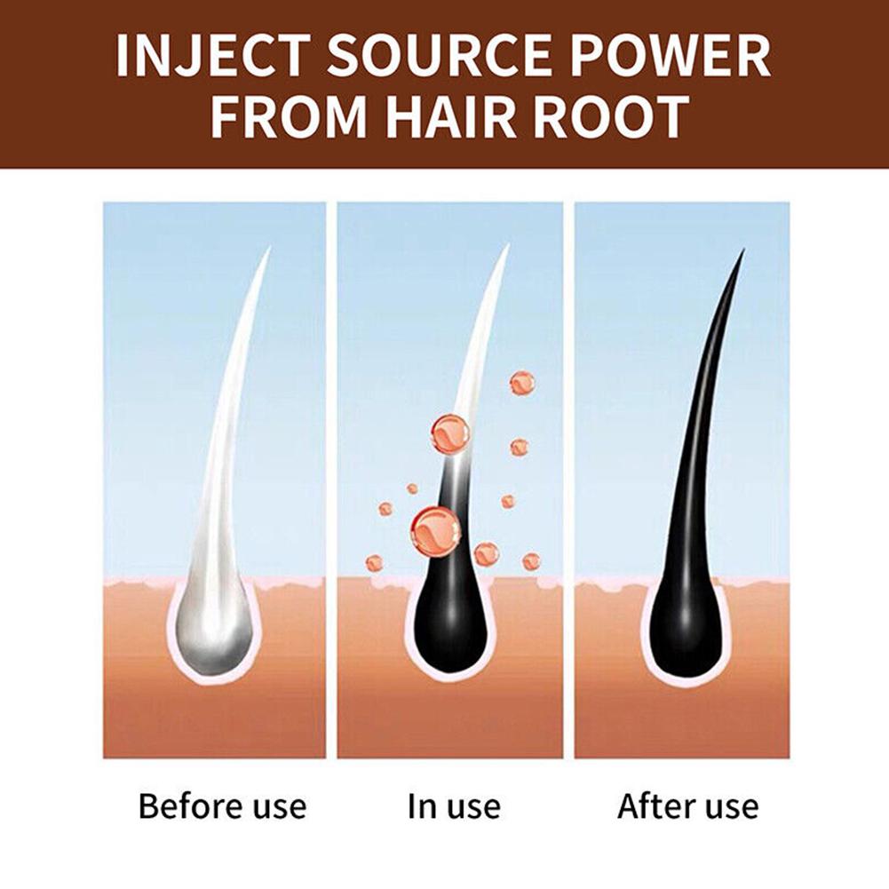 Natural Polygonum Handmade Soa - Hair Care Dandruff 리뷰 및 가격